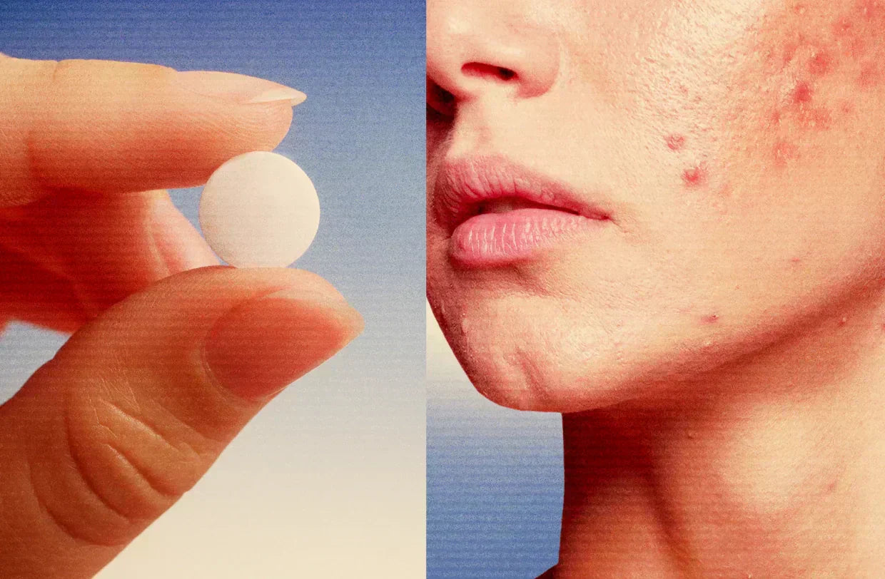 Anticonceptivos hormonales y cambios en la piel