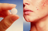 Anticonceptivos hormonales y cambios en la piel