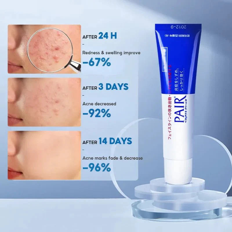 [LION] Pair Acne Cream W [24g] - Treatment